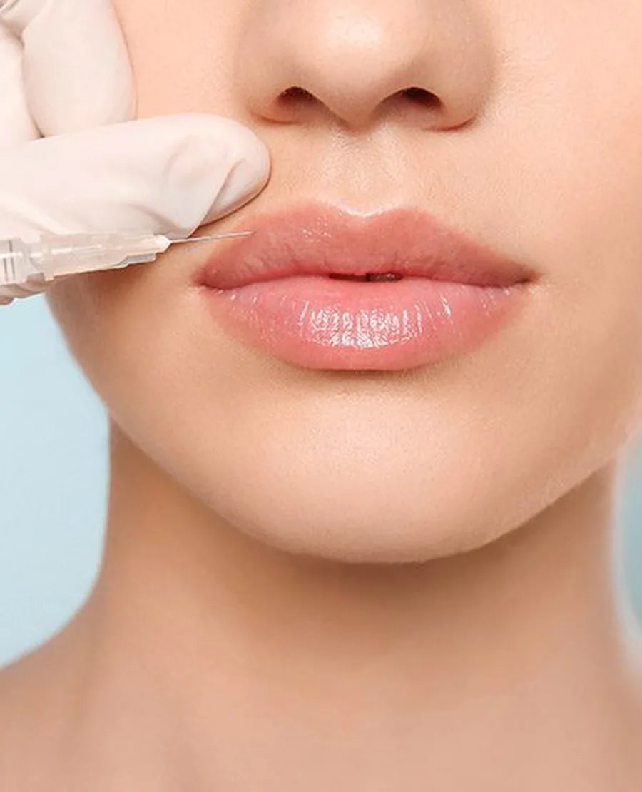 Lip filler being injected with hyaluronic acid gel at Aeconic Aesthetic Clinic, Berawa, Canggu, Bali