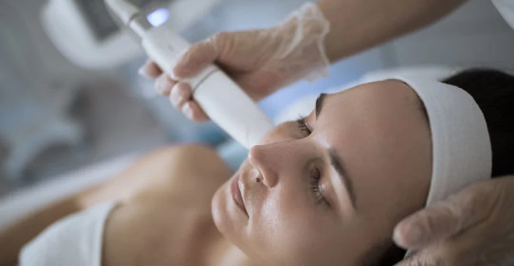 HIFU session in progress with the applicator worked across the cheek at Aeconic Aesthetic Clinic, Canggu, Bali