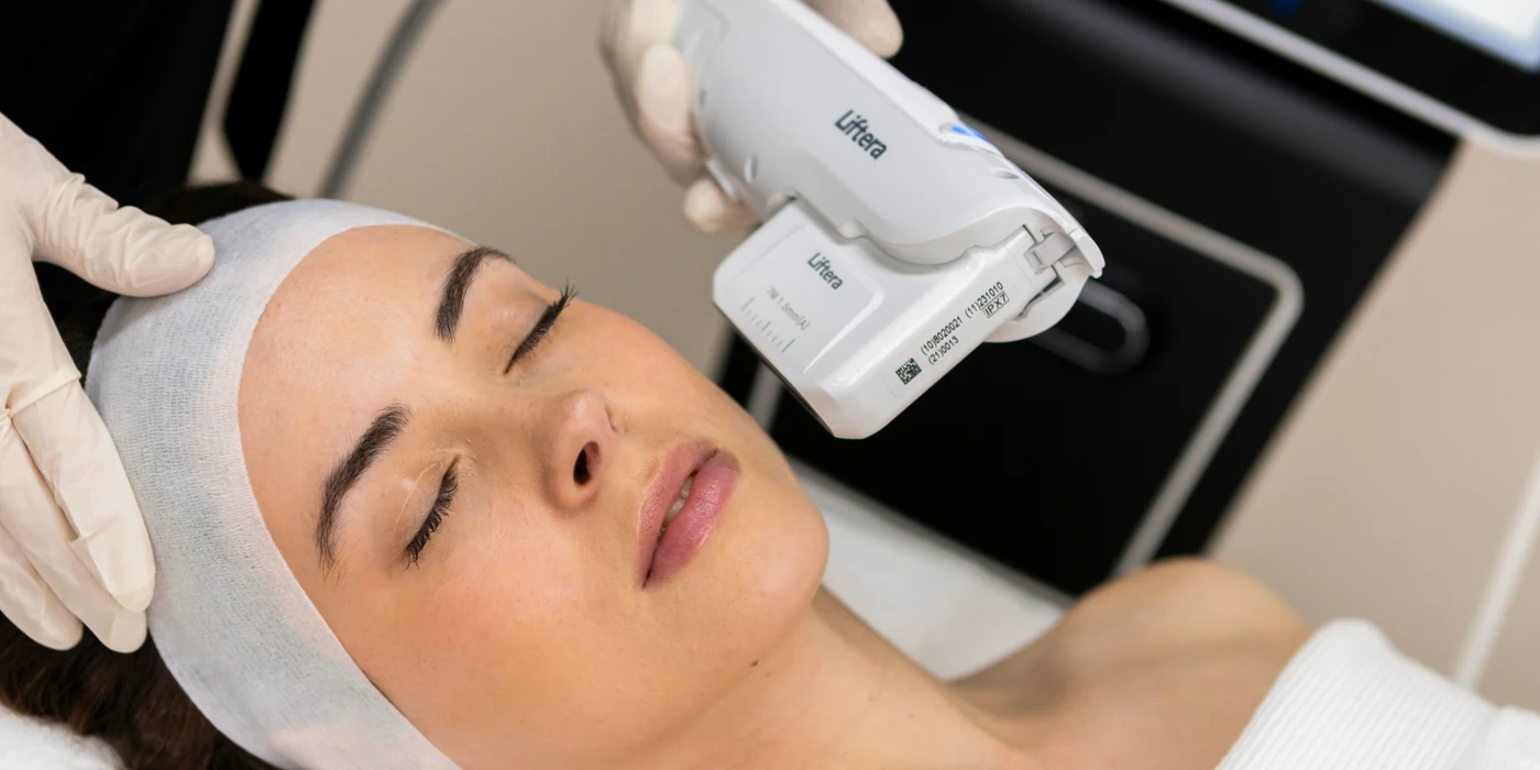 Liftera 2 HIFU applicator delivering focused ultrasound along the cheek and jawline during treatment at Aeconic Clinic, Canggu, Bali