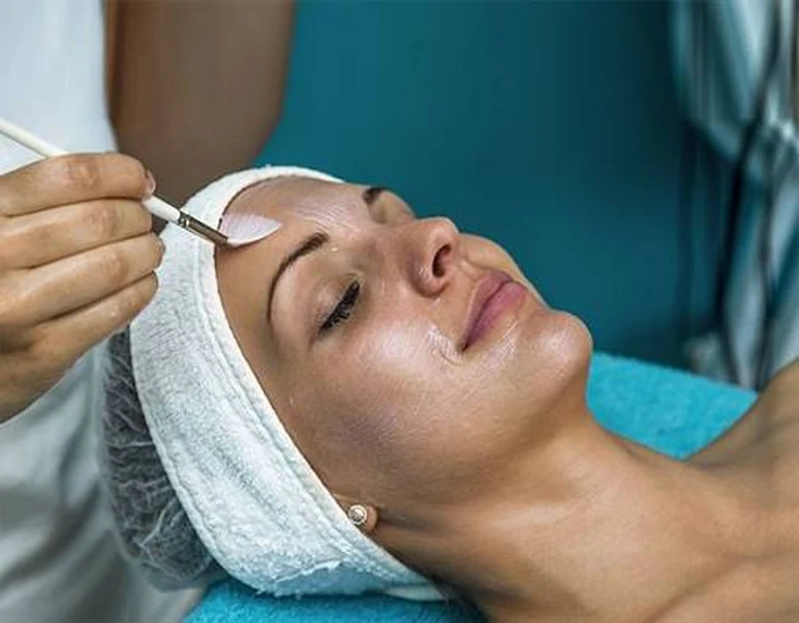 Chemical peel solution applied to a targeted area of the face during treatment in Canggu, Bali